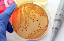 微生物試験のイメージ